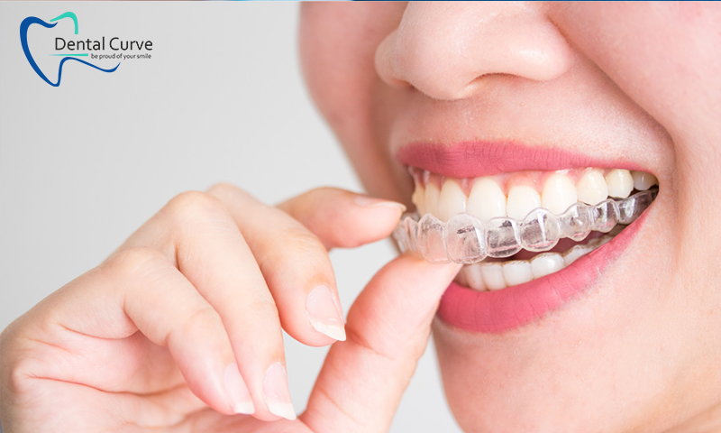 Why are invisible braces the right choice?