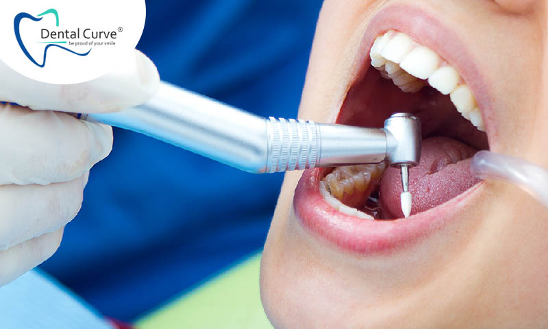 How often do you need to do a dental checkup?